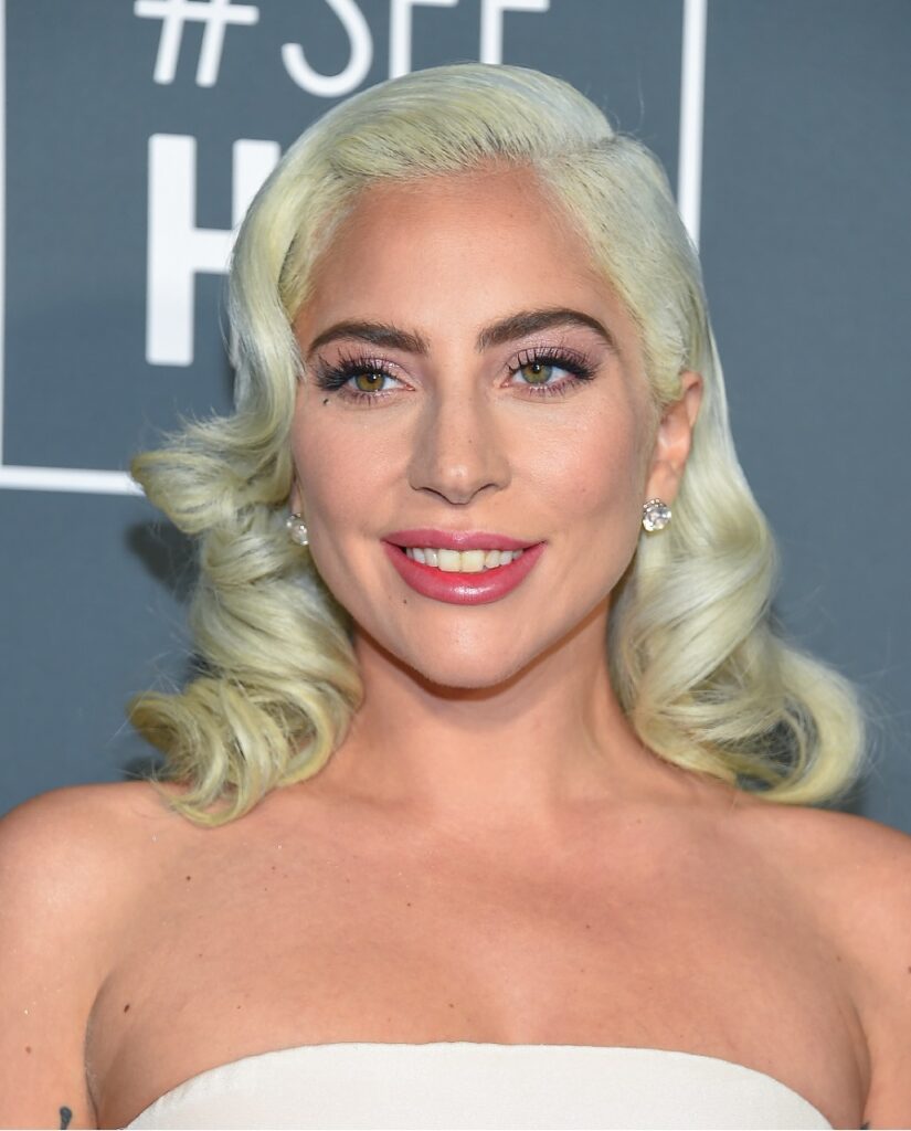 Lady-Gaga-Celebrities-with-Mental-Health-Issues-and-What-We-Can-Learn-From-Them-iMind-Mental-Health-Solutions