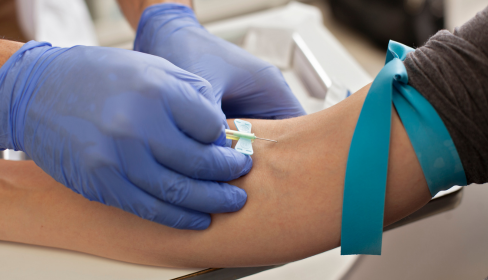 blood-test-how-vitamin-D-affects-mental-health-iMind-Mental-Health-Solutions