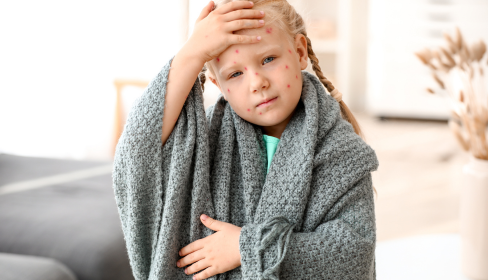 little-girl-with-a-blanket-around-her-with-spots-on-her-face-and-one-hand-on-her-head-and-next-on-her-stomach-how-divorce-affects-the-children-iMind-Mental-Health-Solutions